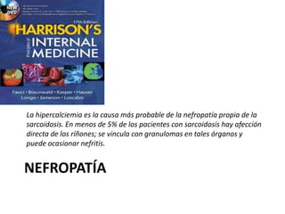 NEFROPATÍA
La hipercalciemia es la causa más probable de la nefropatía propia de la
sarcoidosis. En menos de 5% de los pacientes con sarcoidosis hay afección
directa de los ríñones; se vincula con granulomas en tales órganos y
puede ocasionar nefritis.
 