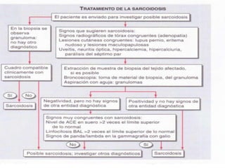Sarcoidosis