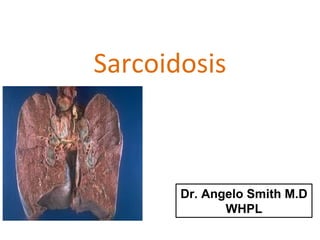 Sarcoidosis
Dr. Angelo Smith M.D
WHPL
 