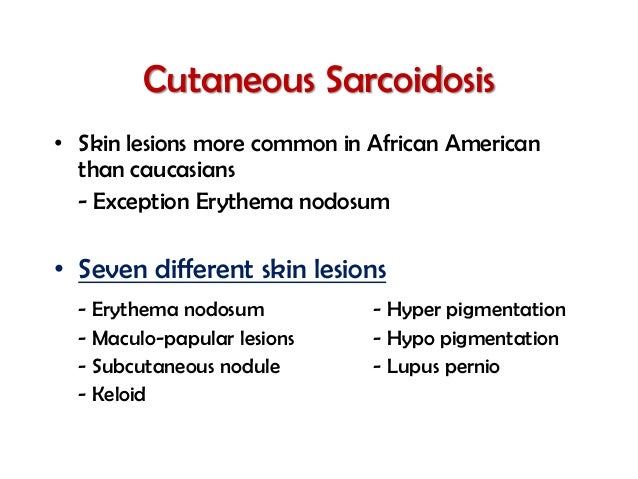 Sarcoidosis