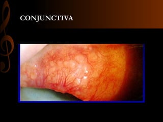 CONJUNCTIVA
 