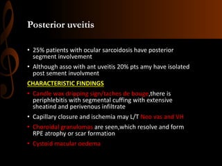 Posterior uveitis
• 25% patients with ocular sarcoidosis have posterior
segment involvement
• Although asso with ant uveitis 20% pts amy have isolated
post sement involvment
CHARACTERISTIC FINDINGS
• Candle wax dripping sign/taches de bouge,there is
periphlebitis with segmental cuffing with extensive
sheatind and perivenous infiltrate
• Capillary closure and ischemia may L/T Neo vas and VH
• Choroidal granulomas are seen,which resolve and form
RPE atrophy or scar formation
• Cystoid macular oedema
 