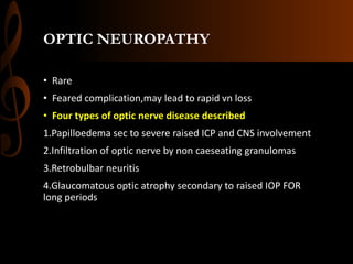 OPTIC NEUROPATHY
• Rare
• Feared complication,may lead to rapid vn loss
• Four types of optic nerve disease described
1.Papilloedema sec to severe raised ICP and CNS involvement
2.Infiltration of optic nerve by non caeseating granulomas
3.Retrobulbar neuritis
4.Glaucomatous optic atrophy secondary to raised IOP FOR
long periods
 