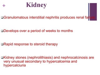 + Kidney
Granulomatous interstitial nephritis produces renal failure
Develops over a period of weeks to months
Rapid response to steroid therapy
Kidney stones (nephrolithiasis) and nephrocalcinosis are
very unusual secondary to hypercalcemia and
hypercalciuria
 