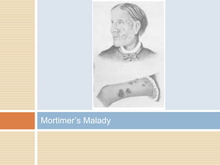 Mortimer’s Malady
 
