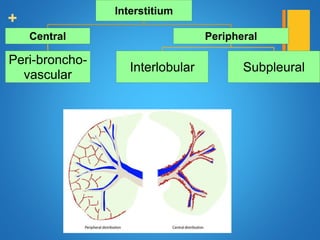 +
Interstitium
Central
Peri-broncho-
vascular
Peripheral
Interlobular Subpleural
 