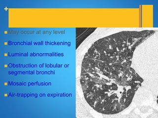 +
Air way involvement
 May occur at any level
 Bronchial wall thickening
 Luminal abnormalities
 Obstruction of lobular or
segmental bronchi
 Mosaic perfusion
 Air-trapping on expiration
 