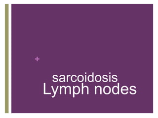 +
Lymph nodes
sarcoidosis
 