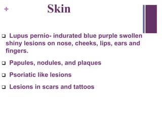 + Skin
 Lupus pernio- indurated blue purple swollen
shiny lesions on nose, cheeks, lips, ears and
fingers.
 Papules, nodules, and plaques
 Psoriatic like lesions
 Lesions in scars and tattoos
 