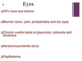 + Eyes
25% have eye lesions
Blurred vision, pain, photophobia and dry eyes
Chronic uveitis leads to glaucoma, cataracts and
blindness
Keratoconjunctivitis sicca
Papilledema
 