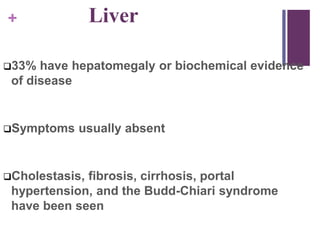 + Liver
33% have hepatomegaly or biochemical evidence
of disease
Symptoms usually absent
Cholestasis, fibrosis, cirrhosis, portal
hypertension, and the Budd-Chiari syndrome
have been seen
 