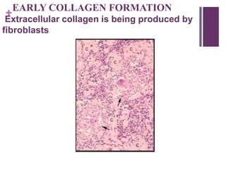 +
EARLY COLLAGEN FORMATION
Extracellular collagen is being produced by
fibroblasts
 
