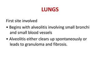 LUNGS
First site involved
• Begins with alveolitis involving small bronchi
and small blood vessels
• Alveolitis either clears up spontaneously or
leads to granuloma and fibrosis.
 