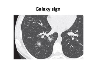 Galaxy sign
 