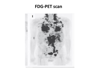 FDG-PET scan
 