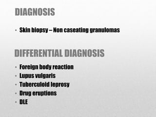 DIAGNOSIS
• Skin biopsy – Non caseating granulomas
DIFFERENTIAL DIAGNOSIS
• Foreign body reaction
• Lupus vulgaris
• Tuberculoid leprosy
• Drug eruptions
• DLE
 