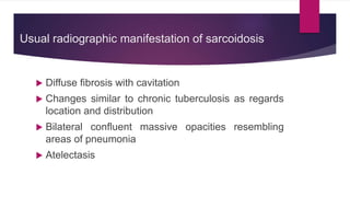 Usual radiographic manifestation of sarcoidosis
 Diffuse fibrosis with cavitation
 Changes similar to chronic tuberculosis as regards
location and distribution
 Bilateral confluent massive opacities resembling
areas of pneumonia
 Atelectasis
 