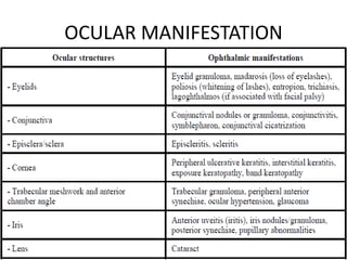 OCULAR MANIFESTATION
 