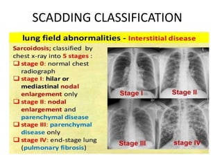SCADDING CLASSIFICATION
 