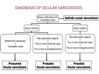 DIAGNOSIS OF OCULAR SARCOIDOSIS
 