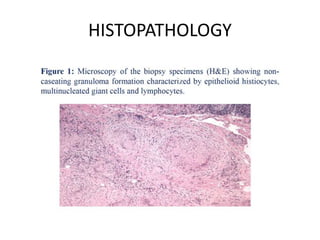 HISTOPATHOLOGY
 
