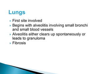 First site involved
 Begins with alveolitis involving small bronchi
and small blood vessels
 Alveolitis either clears up spontaneously or
leads to granuloma
 Fibrosis
 
