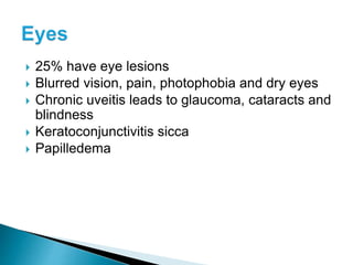  25% have eye lesions
 Blurred vision, pain, photophobia and dry eyes
 Chronic uveitis leads to glaucoma, cataracts and
blindness
 Keratoconjunctivitis sicca
 Papilledema
 
