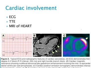  ECG
 TTE
 MRI of HEART
 