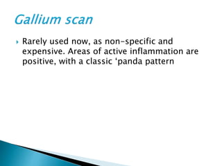  Rarely used now, as non-specific and
expensive. Areas of active inflammation are
positive, with a classic ‘panda pattern
 
