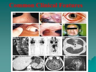 Common Clinical Features
 
