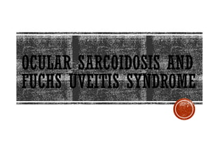 Comprehensive Overview of Ocular Sarcoidosis and Fuchs Uveitis Syndrome ...