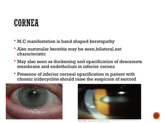 Comprehensive Overview of Ocular Sarcoidosis and Fuchs Uveitis Syndrome ...