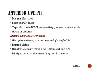 Comprehensive Overview of Ocular Sarcoidosis and Fuchs Uveitis Syndrome ...