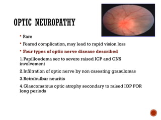 Comprehensive Overview of Ocular Sarcoidosis and Fuchs Uveitis Syndrome ...