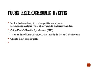 Comprehensive Overview of Ocular Sarcoidosis and Fuchs Uveitis Syndrome ...