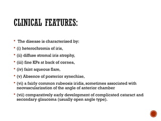Comprehensive Overview of Ocular Sarcoidosis and Fuchs Uveitis Syndrome ...