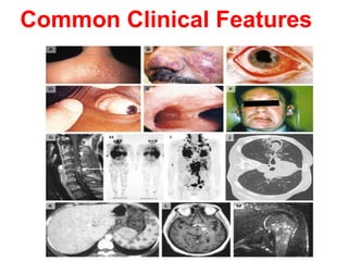 Common Clinical Features
 