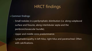  Common findings:
 Small nodules in a perilymphatic distribution (i.e. along subpleural
surface and fissures, along interlobular septa and the
peribronchovascular bundle).
 Upper and middle zone predominance.
 Lymphadenopathy in left hilus, right hilus and paratracheal. Often
with calcifications.
 