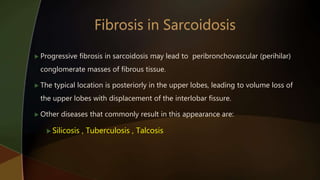  Progressive fibrosis in sarcoidosis may lead to peribronchovascular (perihilar)
conglomerate masses of fibrous tissue.
 The typical location is posteriorly in the upper lobes, leading to volume loss of
the upper lobes with displacement of the interlobar fissure.
 Other diseases that commonly result in this appearance are:
 Silicosis , Tuberculosis , Talcosis
 