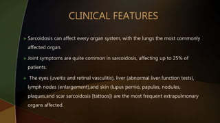  Sarcoidosis can affect every organ system, with the lungs the most commonly
affected organ.
 Joint symptoms are quite common in sarcoidosis, affecting up to 25% of
patients.
 The eyes (uveitis and retinal vasculitis), liver (abnormal liver function tests),
lymph nodes (enlargement),and skin (lupus pernio, papules, nodules,
plaques,and scar sarcoidosis [tattoos]) are the most frequent extrapulmonary
organs affected.
 