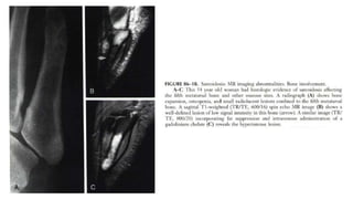 Sarcoidosis imaging