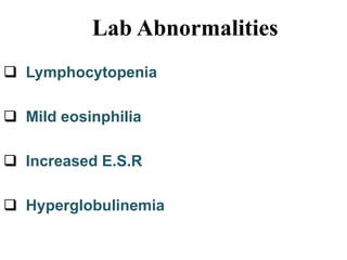 Lab Abnormalities
 Lymphocytopenia
 Mild eosinphilia
 Increased E.S.R
 Hyperglobulinemia
 