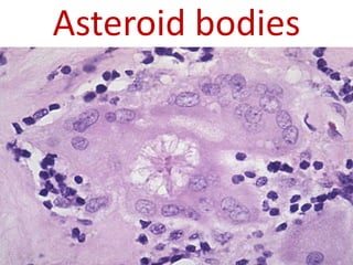 Asteroid bodies
 