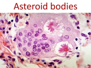 Asteroid bodies
 