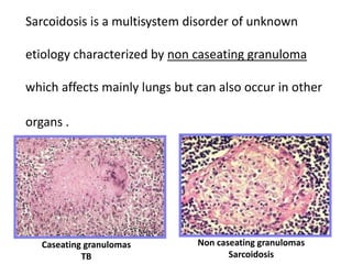 Sarcoidosis is a multisystem disorder of unknown
etiology characterized by non caseating granuloma
which affects mainly lungs but can also occur in other
organs .
Caseating granulomas
TB
Non caseating granulomas
Sarcoidosis
 