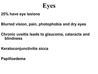 Eyes
25% have eye lesions
Blurred vision, pain, photophobia and dry eyes
Chronic uveitis leads to glaucoma, cataracts and
blindness
Keratoconjunctivitis sicca
Papilloedema
 