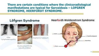 10
There are certain conditions where the clinicoradiological
manifestations are typical for Sarcoidosis – LOFGREN
SYNDROME, HEERFORDT SYNDROME.
 