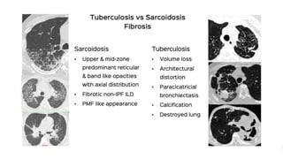 MM.DD.20XX
ADD A FOOTER
25
 