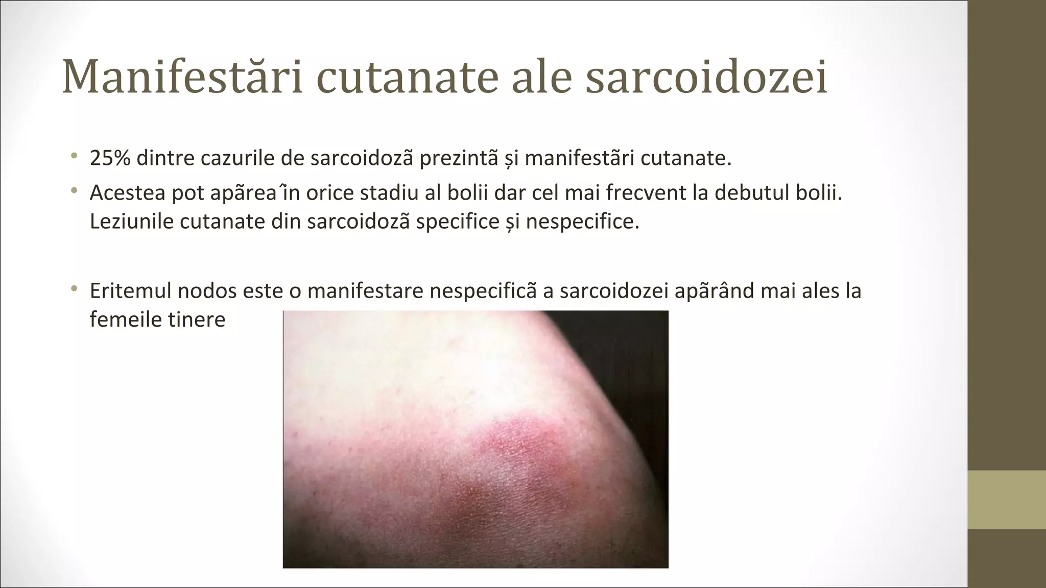 Manifestări cutanate ale sarcoidozei
• 25% dintre cazurile de sarcoidozã prezintã și manifestãri cutanate.
• Acestea pot apãrea în orice stadiu al bolii dar cel mai frecvent la debutul bolii.
Leziunile cutanate din sarcoidozã specifice și nespecifice.
• Eritemul nodos este o manifestare nespecificã a sarcoidozei apãrând mai ales la
femeile tinere
 