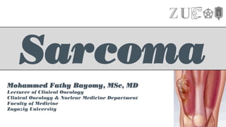 Sarcoma
Mohammed Fathy Bayomy, MSc, MD
Lecturer of Clinical Oncology
Clinical Oncology & Nuclear Medicine Department
Faculty of Medicine
Zagazig University
 